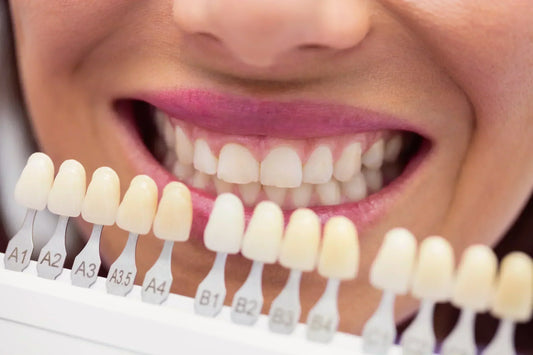 Understanding Yellowing of Teeth