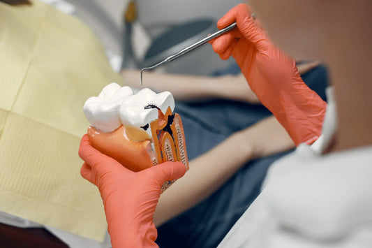 Understanding Dental Cavities